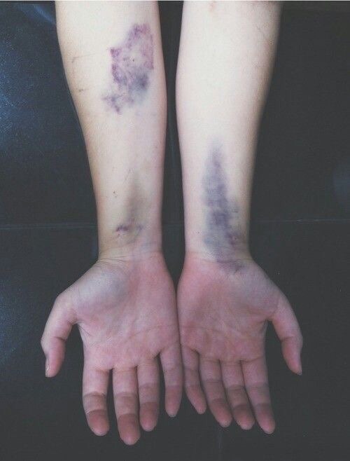 Shouldn't have had to tell her twice... — 17
